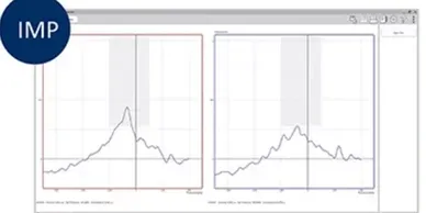Tympanometry middle ear test Bundaberg